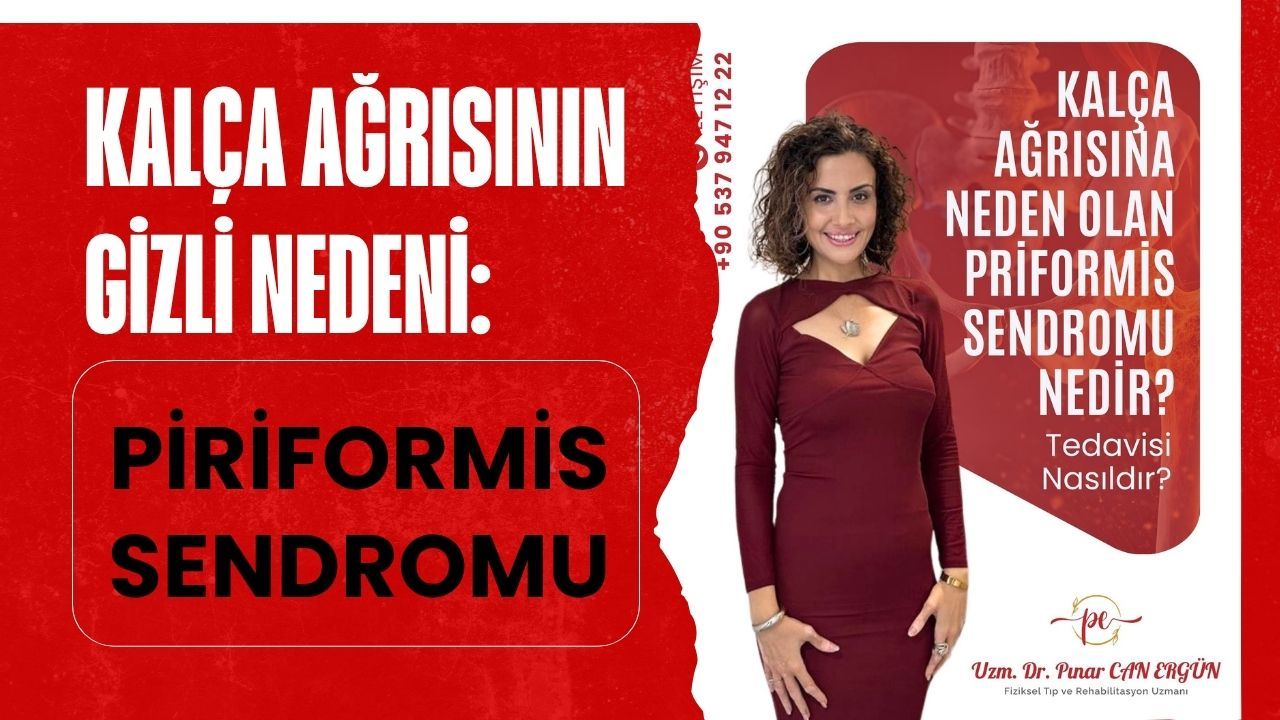 Kalça Ağrısının Gizli Nedeni: Piriformis Sendromu