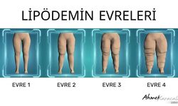 Prof. Karacalar: “Bu Bir Obezite Değil, Evrimsel Miras”