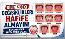Dilinizdeki Değişiklikleri Hafife Almayın, Uzmanlardan Erken Teşhis Uyarısı