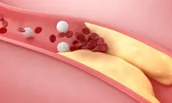Kandaki Yağı Düşüren Bitkiler Hangileri? Uzmanlardan Uyarı