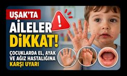 Dikkat! Çocuklarda El, Ayak ve Ağız Hastalığına Karşı Uyarı