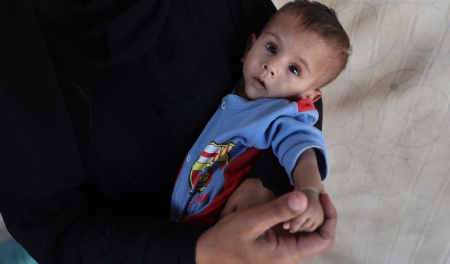 UNICEF: “Gazze’de Bebekler Yetersiz Beslenmeyle Ölüyor”