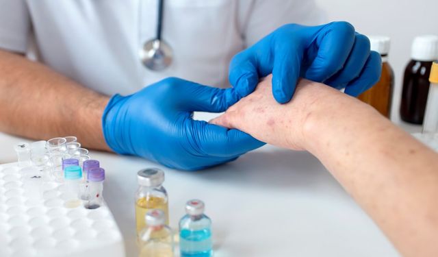 50 Yaş Üstüne Uyarı, Zona Virüsü Yıllar Sonra Uyanabilir