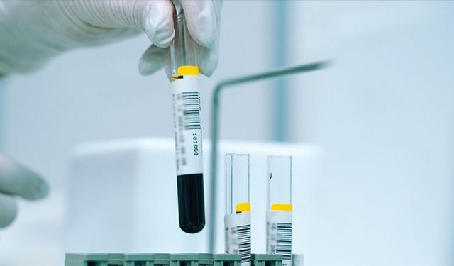 Sağlık Bakanlığı Uyardı: Evlilik Öncesi Test Hayat Kurtarıyor