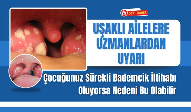 Uşaklı Ailelere Uzmanlardan Uyarı: Çocuğunuz Sürekli Bademcik İltihabı Oluyorsa Nedeni Bu Olabilir
