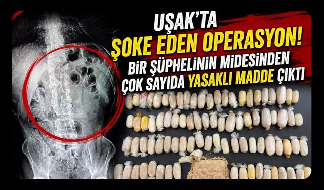 Uşak'ta Şoke Eden Operasyon! Bir Şüphelinin Midesinden Çok Sayıda Yasaklı Madde Çıktı