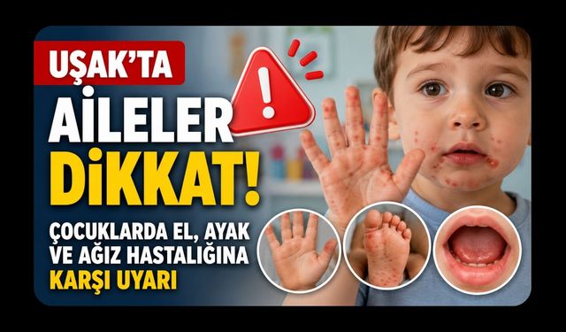 Dikkat! Çocuklarda El, Ayak ve Ağız Hastalığına Karşı Uyarı