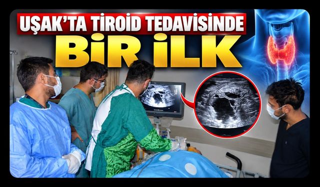 Uşak’ta Tiroid Tedavisinde Bir İlk: 3 Hastaya Ameliyatsız Ablasyon Uygulandı