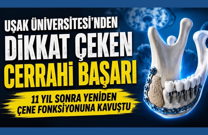 Uşak Üniversitesi'nden Dikkat Çeken Cerrahi Başarı, 11 Yıl Sonra Yeniden Çene Fonksiyonuna Kavuştu