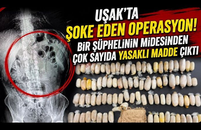 Uşak'ta Şoke Eden Operasyon! Bir Şüphelinin Midesinden Çok Sayıda Yasaklı Madde Çıktı