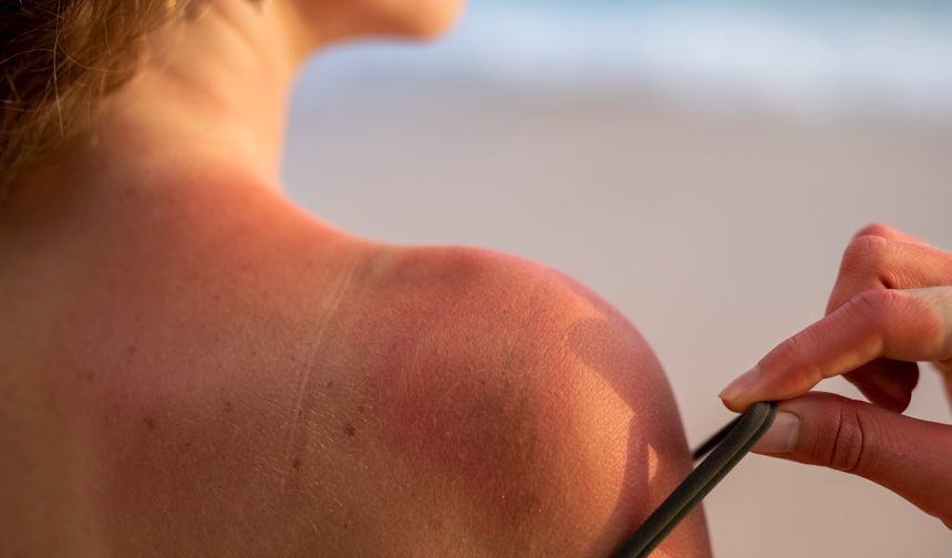 Bronzlaşma Nedir? Sağlıklı Bronzlaşma İçin Uzman Önerileri