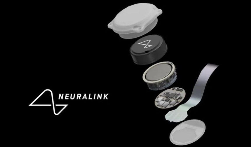 Neuralink Körlüğe Umut Olan Cihazını İlk Kez İnsanda Deniyor