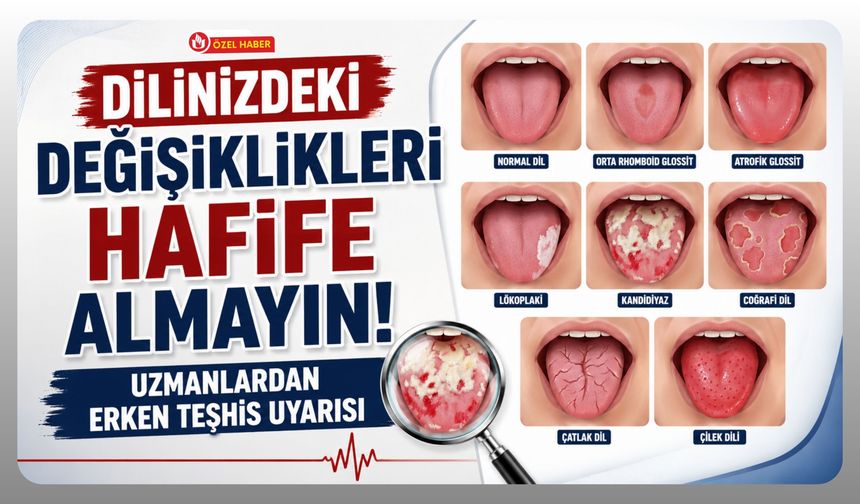 Dilinizdeki Değişiklikleri Hafife Almayın, Uzmanlardan Erken Teşhis Uyarısı