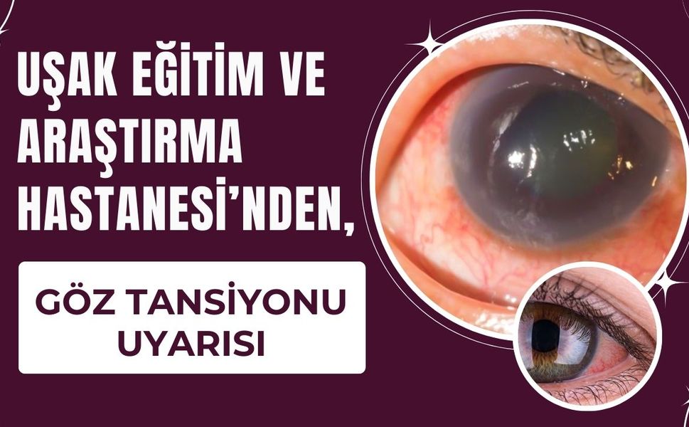 Uşak Eğitim ve Araştırma Hastanesi’nden, Göz Tansiyonu Uyarısı