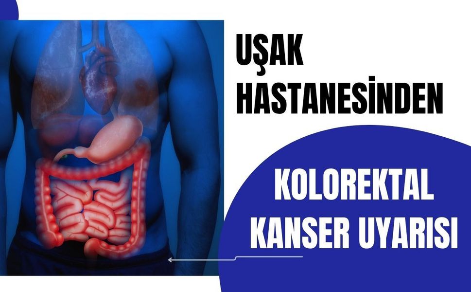 Uşak Hastanesinden Kolorektal Kanser Uyarısı