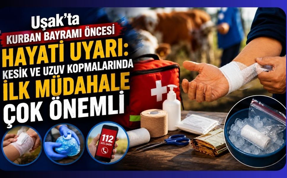 Uşak’ta Kurban Bayramı Öncesi Hayati Uyarı: Kesik ve Uzuv Kopmalarında İlk Müdahale Çok Önemli