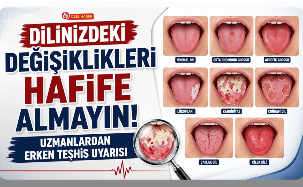 Dilinizdeki Değişiklikleri Hafife Almayın, Uzmanlardan Erken Teşhis Uyarısı