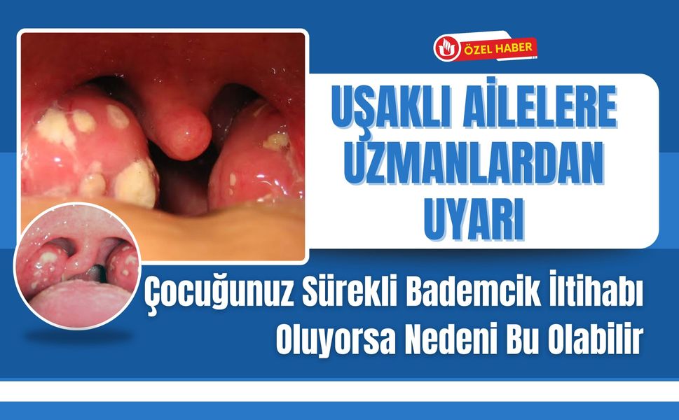 Uşaklı Ailelere Uzmanlardan Uyarı: Çocuğunuz Sürekli Bademcik İltihabı Oluyorsa Nedeni Bu Olabilir
