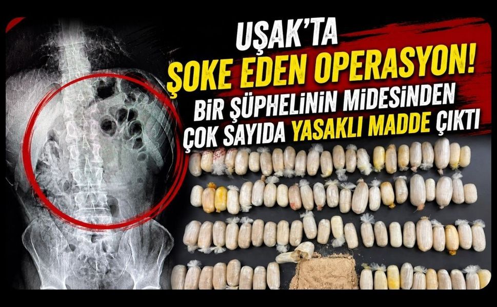 Uşak'ta Şoke Eden Operasyon! Bir Şüphelinin Midesinden Çok Sayıda Yasaklı Madde Çıktı