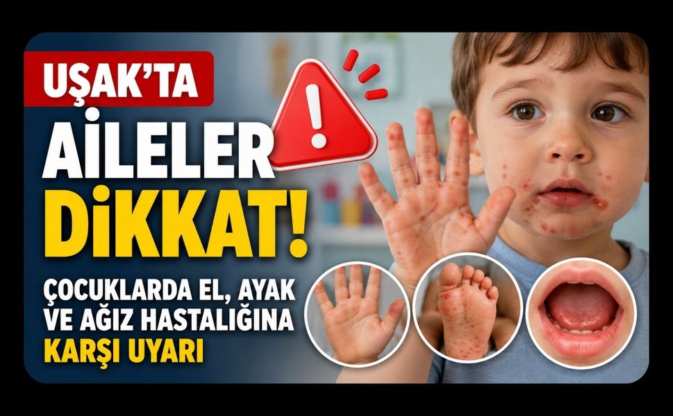 Dikkat! Çocuklarda El, Ayak ve Ağız Hastalığına Karşı Uyarı