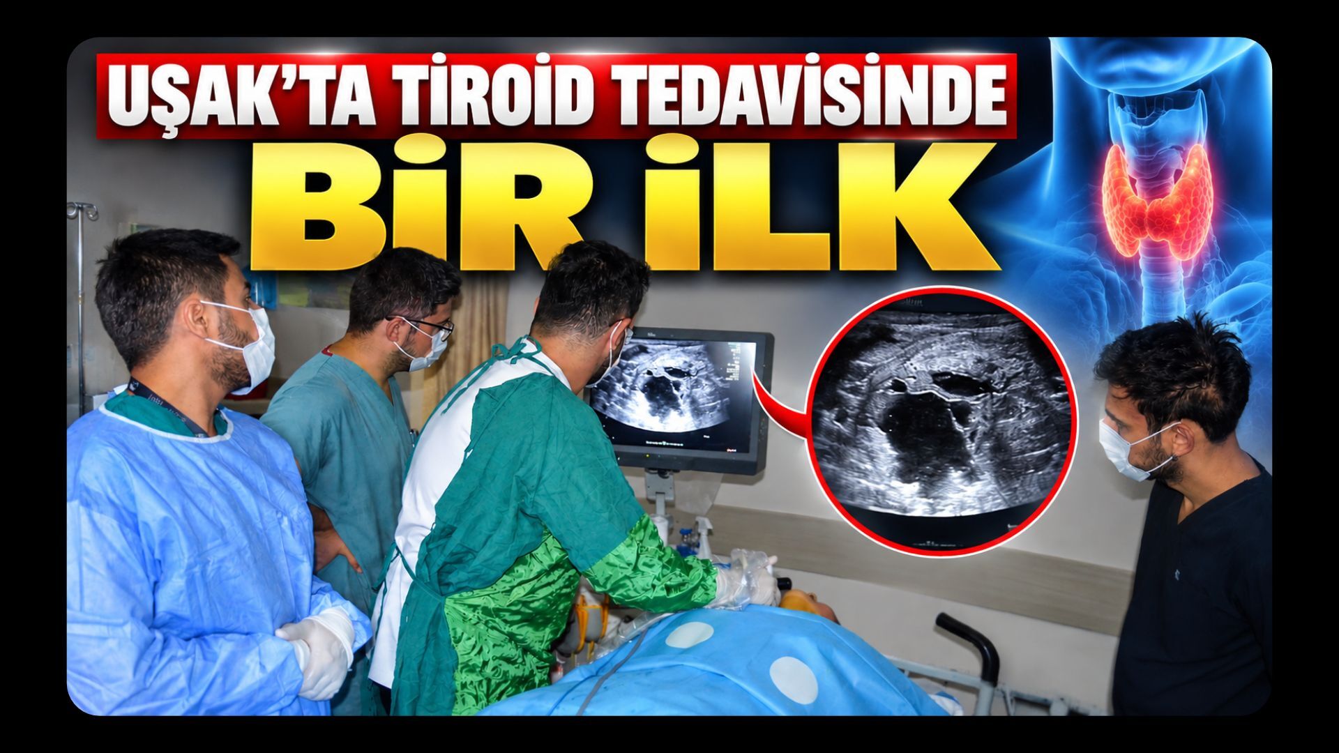 Uşak’ta Tiroid Tedavisinde Bir İlk: 3 Hastaya Ameliyatsız Ablasyon Uygulandı